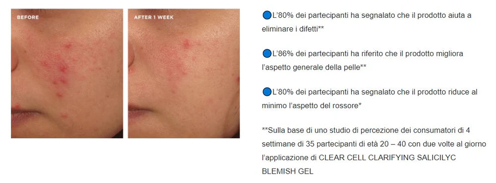 NEW CLEAR CELL BLEMISH GEL IMPERFEZIONI