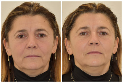 IMAGE MD RESTORING BRIGHTENING CREMA CORRETTIVA