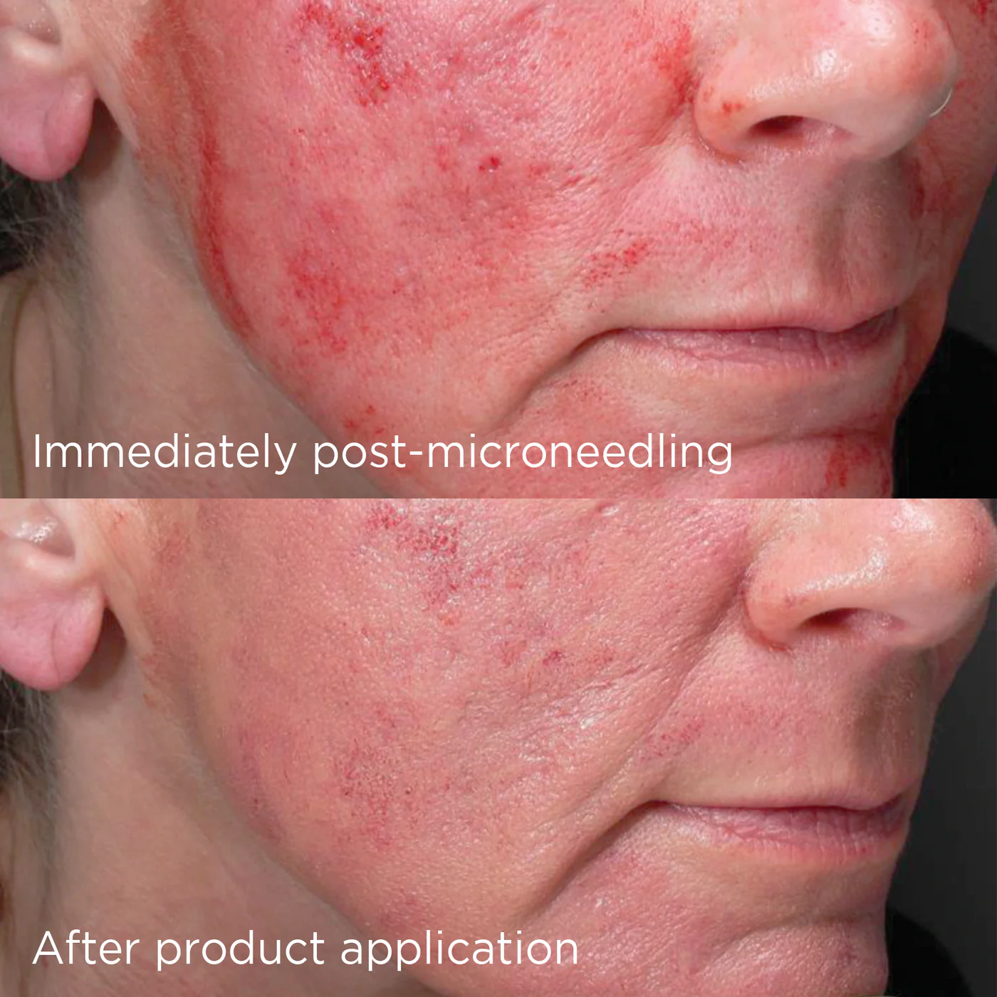 DAILY PREVENTION advanced smartblend mineral moisturizer SPF 50+