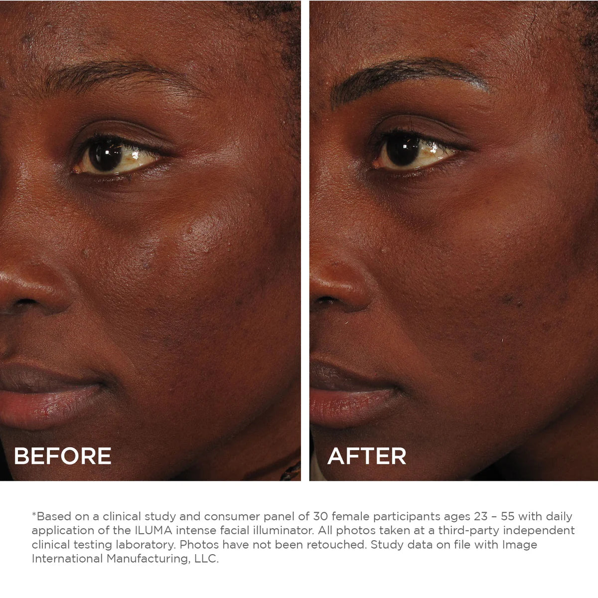 Iluma SIERO BOOSTER VISO ILLUMINANTE 30 ml