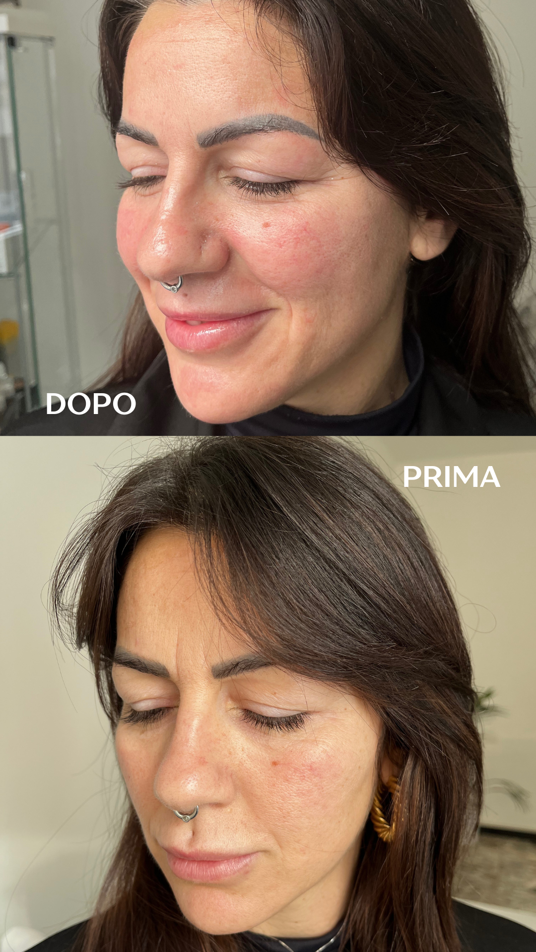 Soins du visage  (metodo Marie)